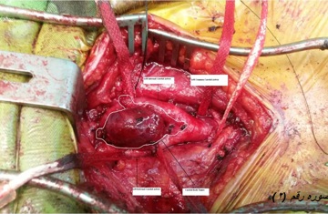 الامراض الباطنية.